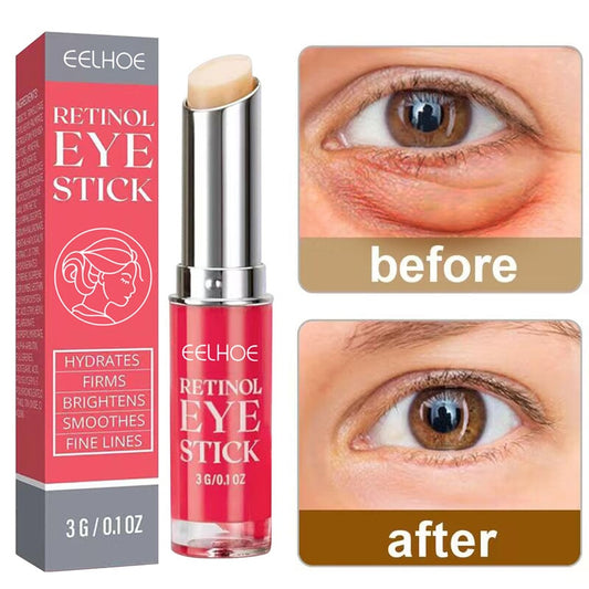 Retinol Eye Cream Anti-Wrinkle Remove Eye Bags Dark Circles Lifting Firming Skin Anti Aging Whitening Moisturizing Skin Care