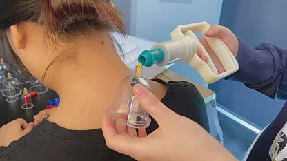 Professional Chinese Acupoint Cupping Therapy Hijama for Massage