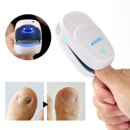 Atang New Fingernails Toenails Toe Nail Fungus Cold Laser Therapy