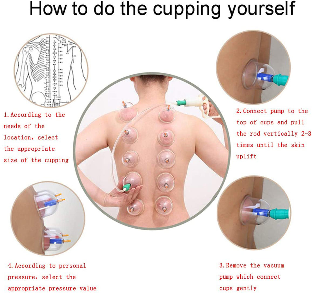 Cupping Massage Cups Therapy Sets Hijama with Vacuum Pump for Body
