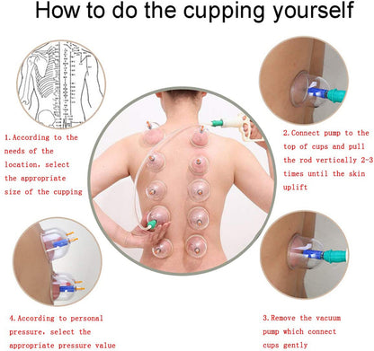 Cupping Massage Cups Therapy Sets Hijama with Vacuum Pump for Body