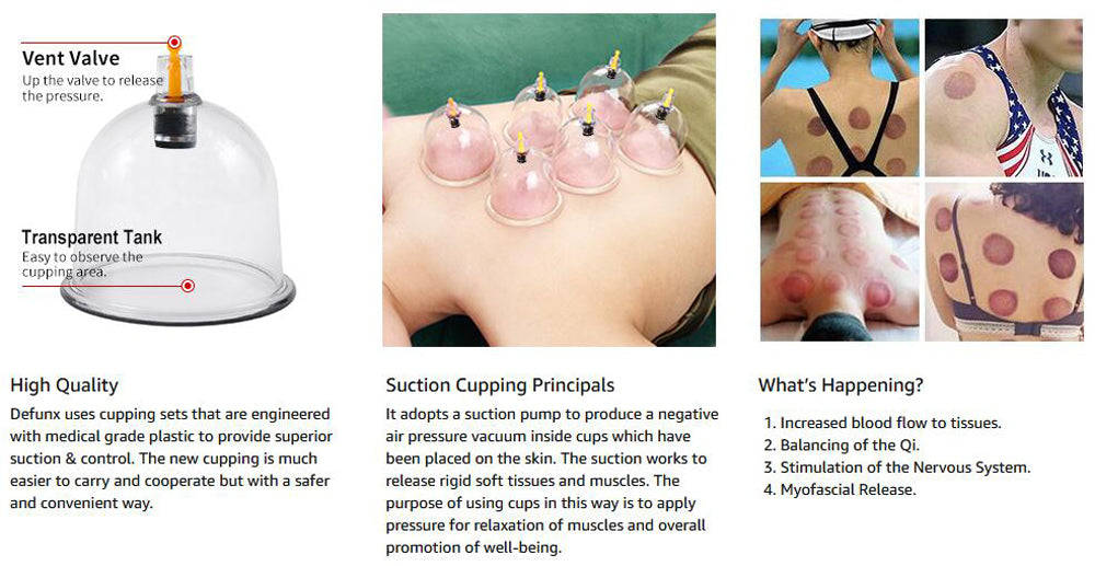 Professional Chinese Acupoint Cupping Therapy Hijama for Massage