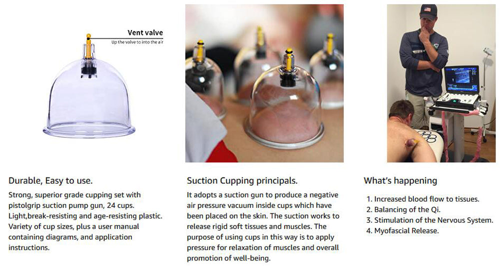 Cupping Therapy Sets Hijama Cupping Vacuum Suction 24 Cups Sets