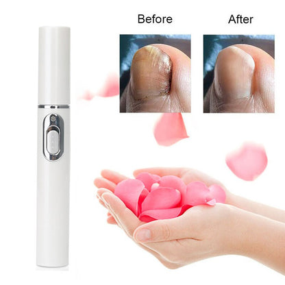 Hot Nail Fungal Treatment Pen Anti Fungus Blue Light Laser Pen