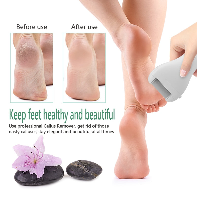 Professional Foot Care Tool Dead Hard Skin Callus Remover