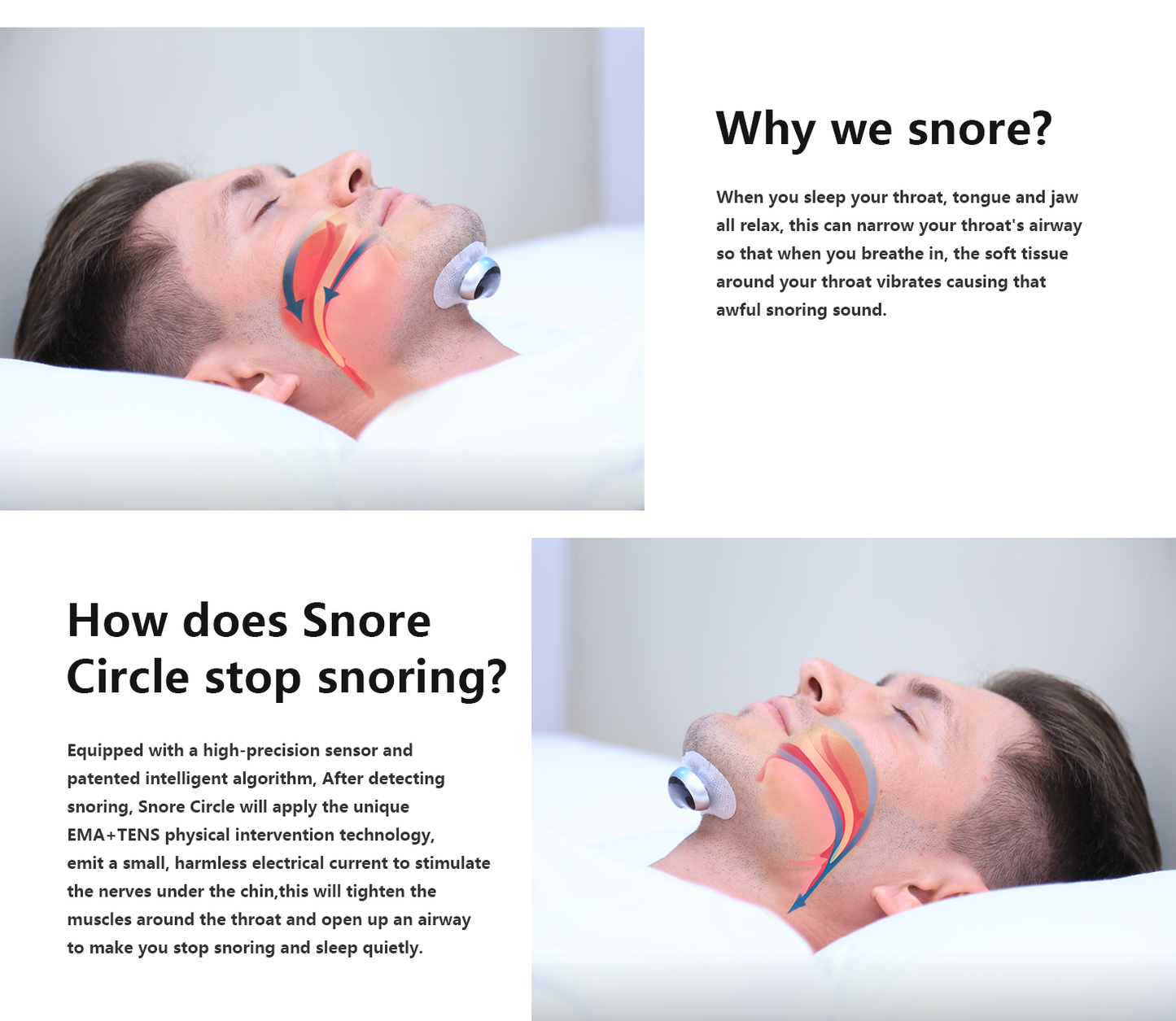 Snore Stopper Anti Snore Prevents Smart Anti-snoring Muscle Stimulator