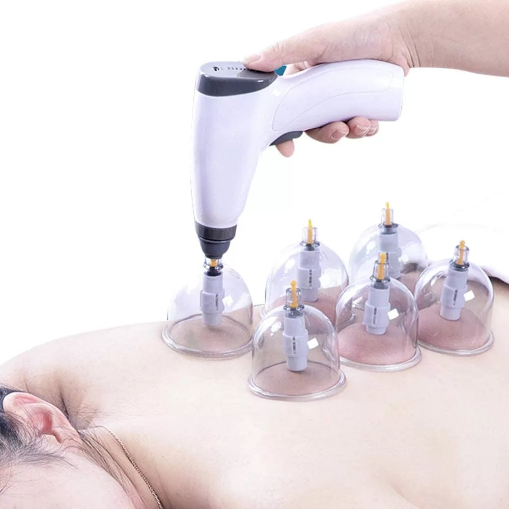 Chinese Medicine Physiotherapy Hijama Suction Cups Massage Body Jar