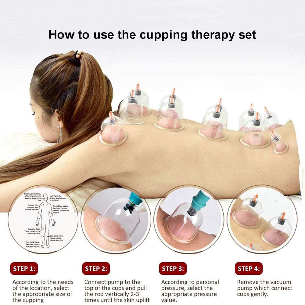 Cupping Therapy Sets Hijama Cupping Vacuum Suction 24 Cups Sets